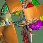 SIGGRAPH 1992: 3D anatomical atlas of the human head