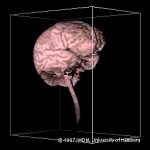 First ever 3D reconstruction of a brain from MRI