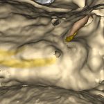 Temporal bone with facial nerve, chorda tympani and stapes in the virtual simulator ...