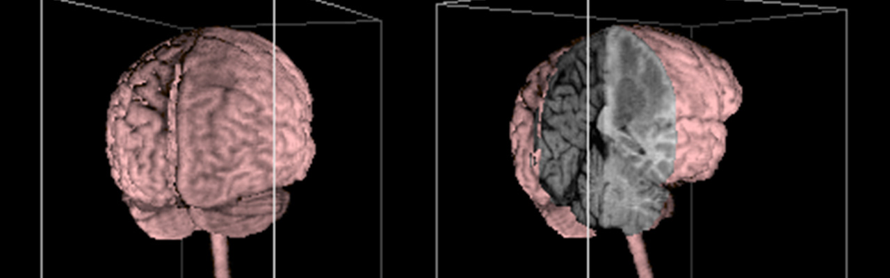 First 3D Reconstruction of the Brain