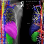 X-ray image with colored organs