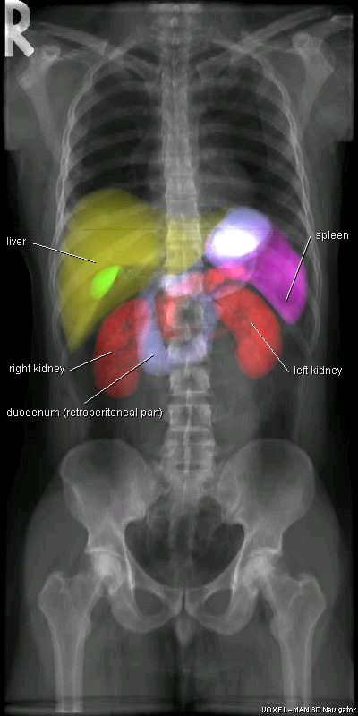 x-ray projections of combined internal organs