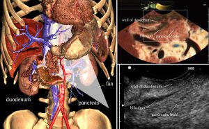 EUS meets VOXEL-MAN training system for endoscopic ultrasound examinations