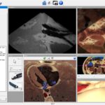 User interface with ultrasound and anatomical cross-sections, endoscopic view and orthogonal navigation images