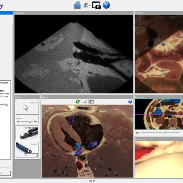 Virtual Training in Endoscopic Ultrasound