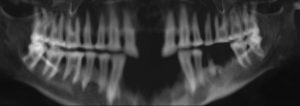 Panoramic radiograph of the Virtual Mummy's teeth
