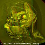 Virtual dissection of the Visible Human's brain in red/green stereo