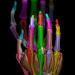 Hand of the Visible Human with X-ray image