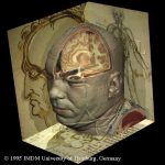 Dissection of the Visible Human's head with two of Leonardo da Vinci's anatomical drawings