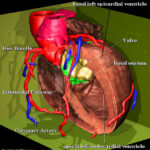 View of the opened left ventricle