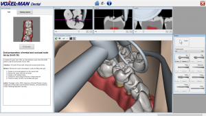 Workscreen of VOXEL-MAN Dental